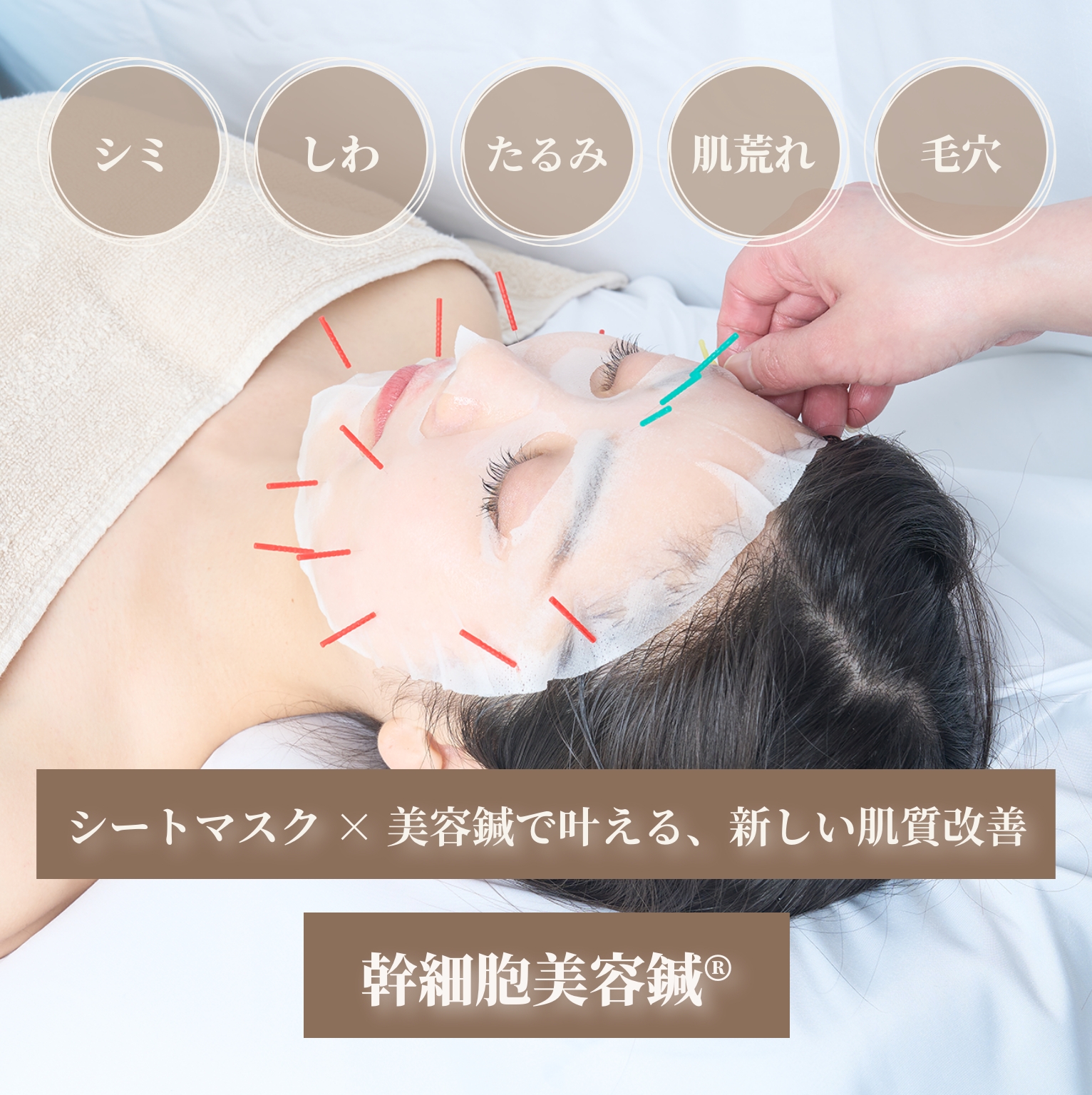 美容鍼の施術を受ける女性