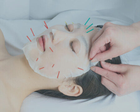 ドッセ鍼灸コンディショニングルームの施術の写真